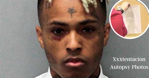 xxxtentacion autopsy photo|Jahseh Onfroy (XXXTentacion) Autopsy Report